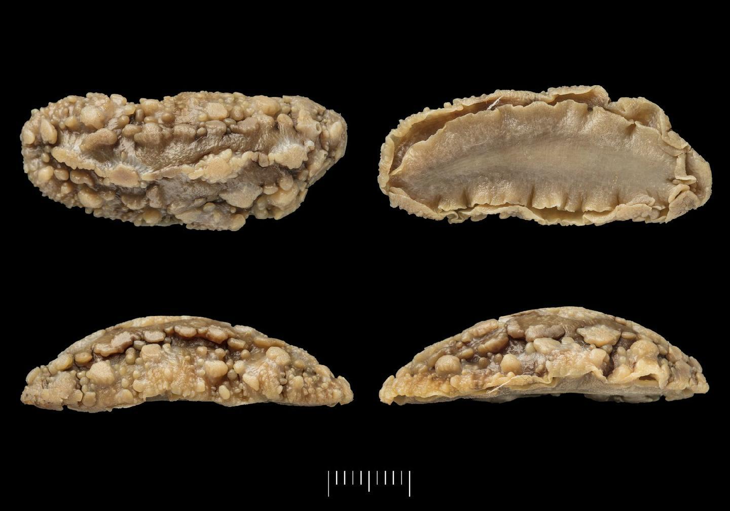 To NHMUK collection (Fryeria pustulosa Gray, 1853; HOLOTYPE & PARATYPE(S); NHMUK:ecatalogue:3512950)