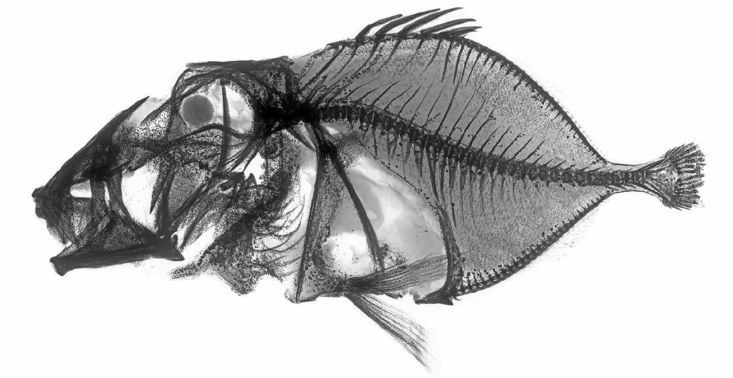 To NHMUK collection (Cyttus roseus (Lowe, 1843); SYNTYPE; NHMUK:ecatalogue:2584371)