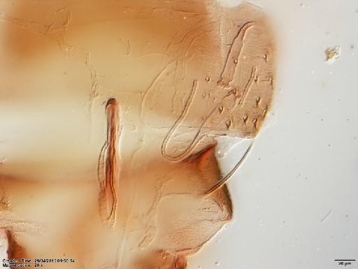 Lutzomyia (Psathyromyia) dasymera Fairchild & Hertig, 1961 - Lutzomyia_dasymera-BMNH(E)1251324_PT-female_spermathecae-20x.tif