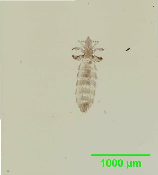 Polyplax oxyrrhynchus Cummings, 1915 - 010155536__2015_12_22-1_s1