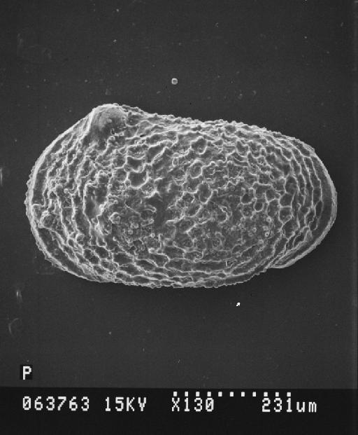 Acanthocythere (Protoacanthocythere) faveolata Bate, 1963 - S2500_063763_Io_560.tif