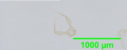 Liposcelis albothoracicus Broadhead, 1955 - 010150241__2016_03_15-4_s06