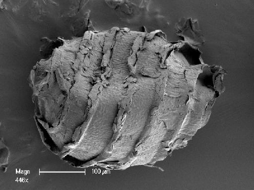 Nitella arthroglochin (A.Braun) Casanova - Oospore